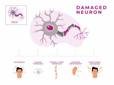 Damaged neuron and symptoms it causes diagram