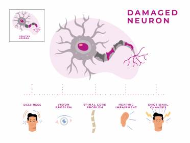 MS Attack (Relapse): Symptoms, Triggers, What To Do